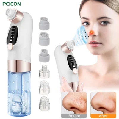 Blackhead Remover Pore Vacuum — Small Bubble Facial Cleansing Machine & Beauty Device | Novelys